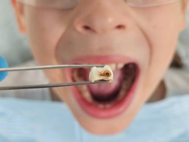Best Emergency Dentist for Special Needs Patients in River Rouge, MI